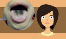 吃瓜尖舌头会黑,吃瓜尖舌头变黑之谜