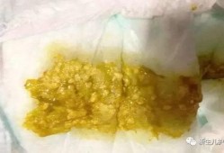 宝宝吃冰瓜拉肚子,预防与应对策略